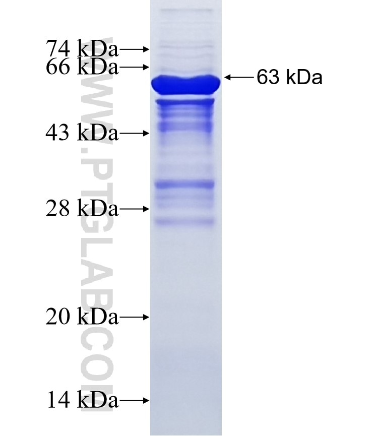 RPS6KB2 fusion protein Ag7371 SDS-PAGE