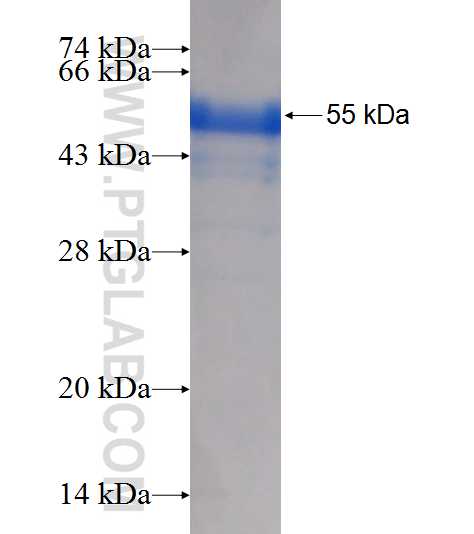RPS6KB2 fusion protein Ag7489 SDS-PAGE