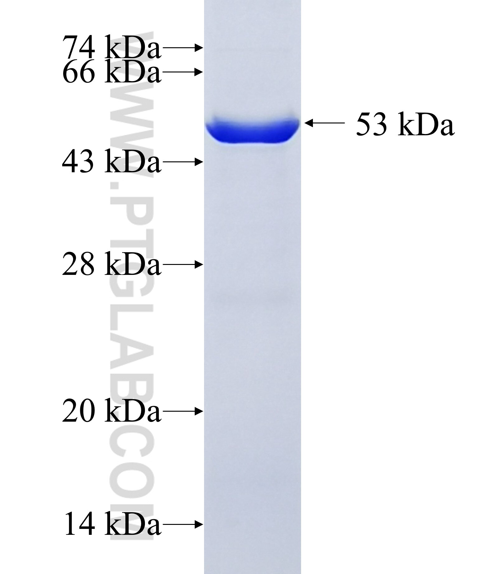 RPS6KC1 fusion protein Ag12569 SDS-PAGE