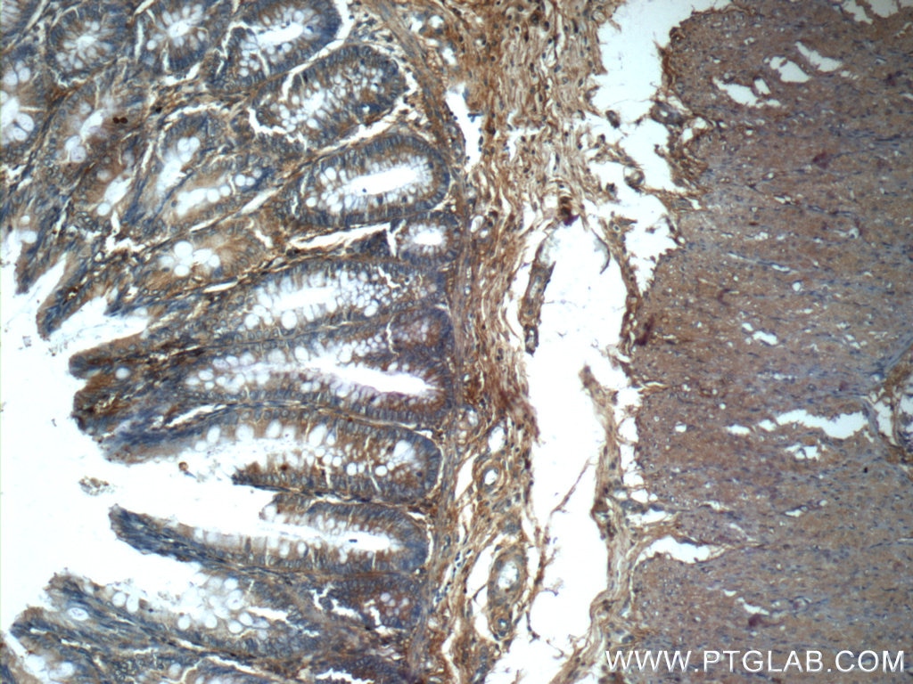 Immunohistochemistry (IHC) staining of human colon tissue using RPS6KL1 Polyclonal antibody (24757-1-AP)