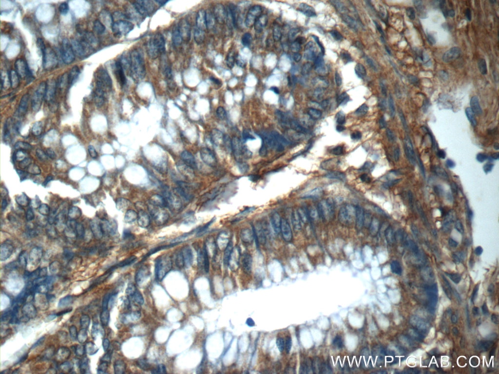 Immunohistochemistry (IHC) staining of human colon tissue using RPS6KL1 Polyclonal antibody (24757-1-AP)