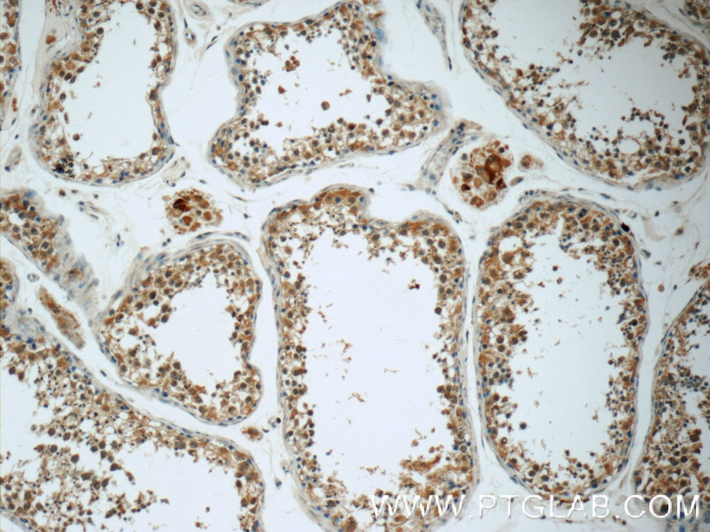 Immunohistochemistry (IHC) staining of human testis tissue using RPS6KL1 Polyclonal antibody (24757-1-AP)