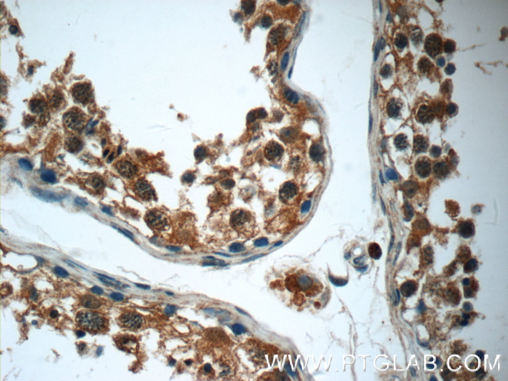Immunohistochemistry (IHC) staining of human testis tissue using RPS6KL1 Polyclonal antibody (24757-1-AP)