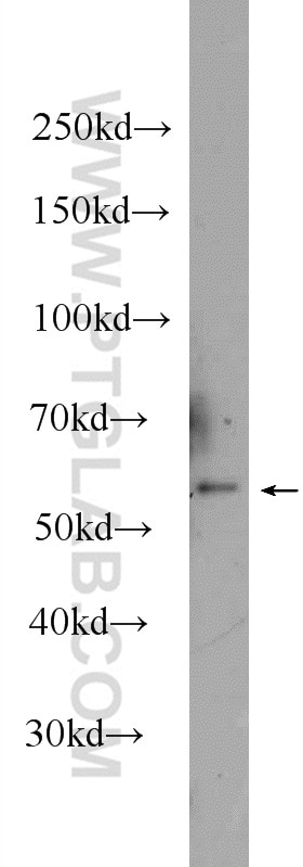 Western Blot (WB) analysis of CHO cells using RPS6KL1 Polyclonal antibody (24757-1-AP)