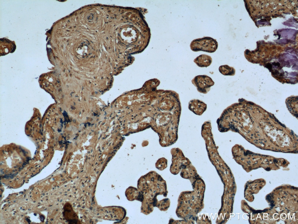 Immunohistochemistry (IHC) staining of human placenta tissue using RPS7 Polyclonal antibody (14491-1-AP)