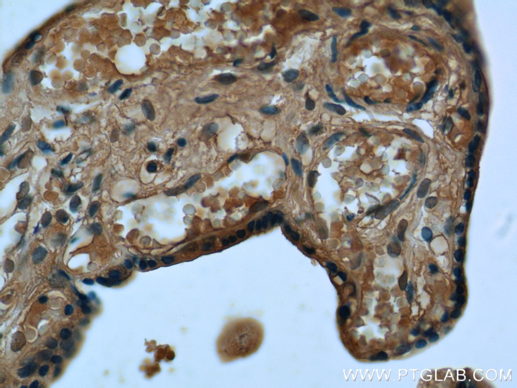 Immunohistochemistry (IHC) staining of human placenta tissue using RPS7 Polyclonal antibody (14491-1-AP)