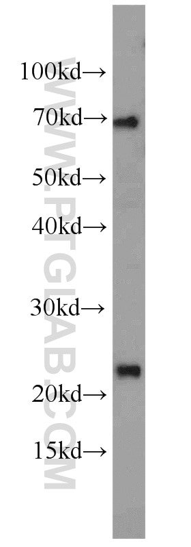 Western Blot (WB) analysis of NIH/3T3 cells using RPS7 Polyclonal antibody (14491-1-AP)