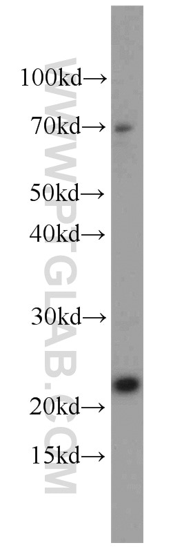 Western Blot (WB) analysis of HepG2 cells using RPS7 Polyclonal antibody (14491-1-AP)