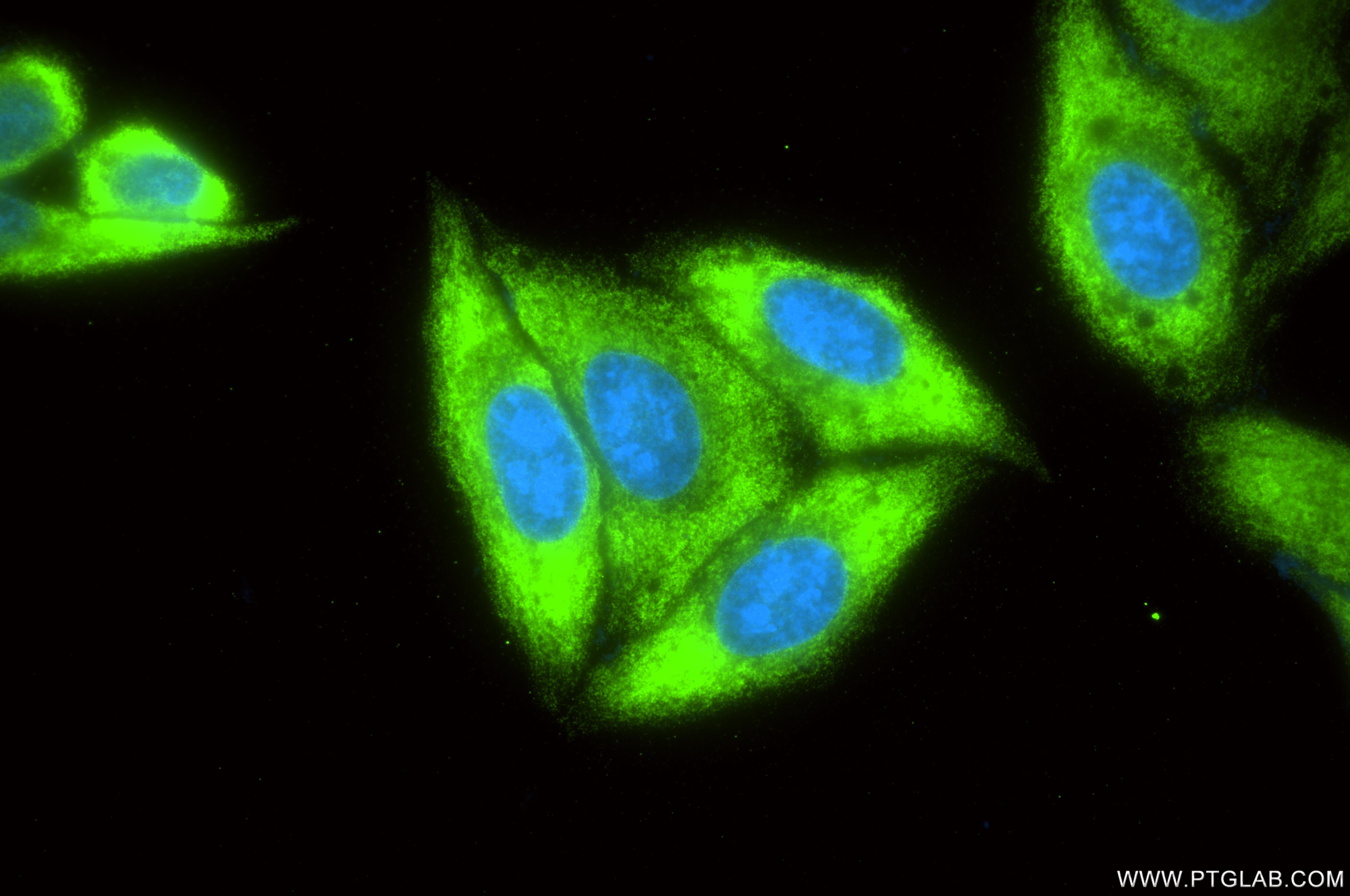 Immunofluorescence (IF) / fluorescent staining of HepG2 cells using RPS7 Recombinant monoclonal antibody (87092-1-RR)