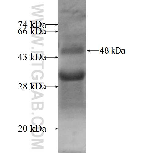 RPS7 fusion protein Ag5892 SDS-PAGE