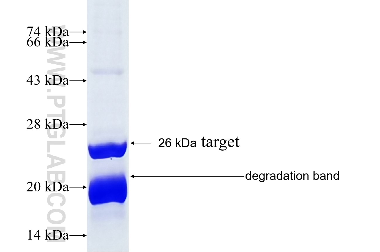 RPS7 fusion protein Ag5999 SDS-PAGE