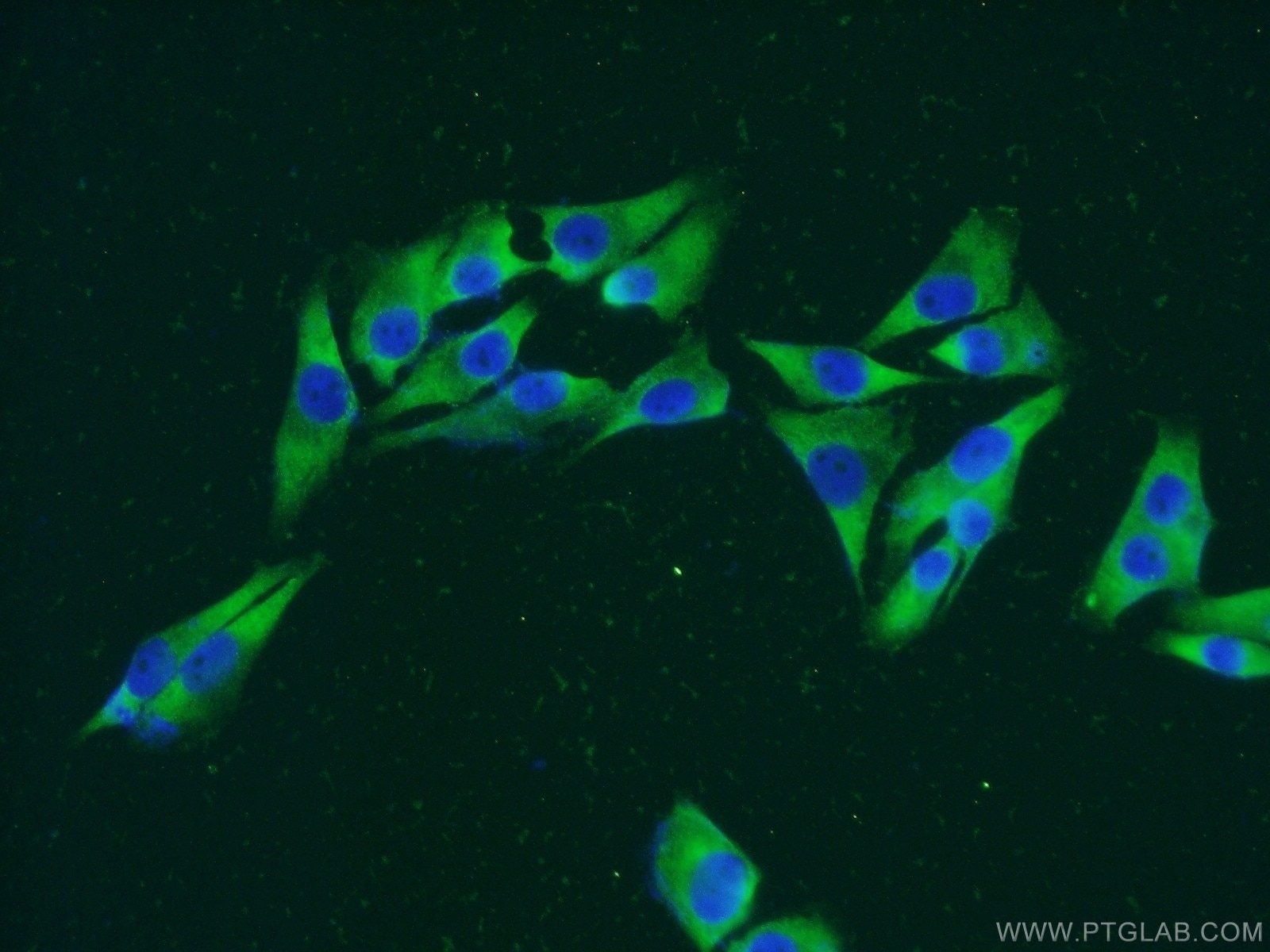 Immunofluorescence (IF) / fluorescent staining of A375 cells using RPS8 Polyclonal antibody (18228-1-AP)