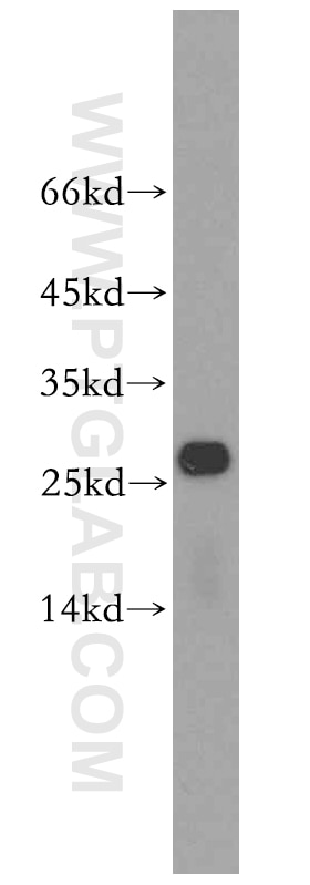 WB analysis of mouse liver using 18228-1-AP