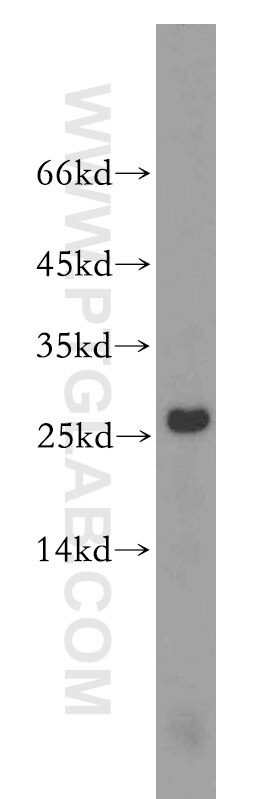 WB analysis of PC-3 using 18228-1-AP