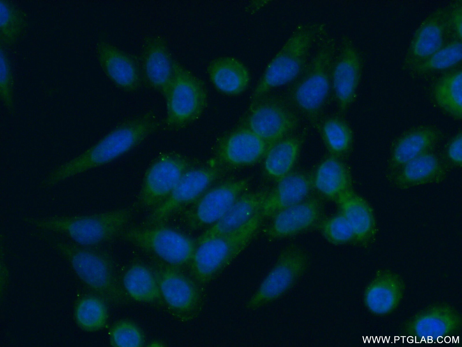 Immunofluorescence (IF) / fluorescent staining of HeLa cells using RPS9 Polyclonal antibody (18215-1-AP)