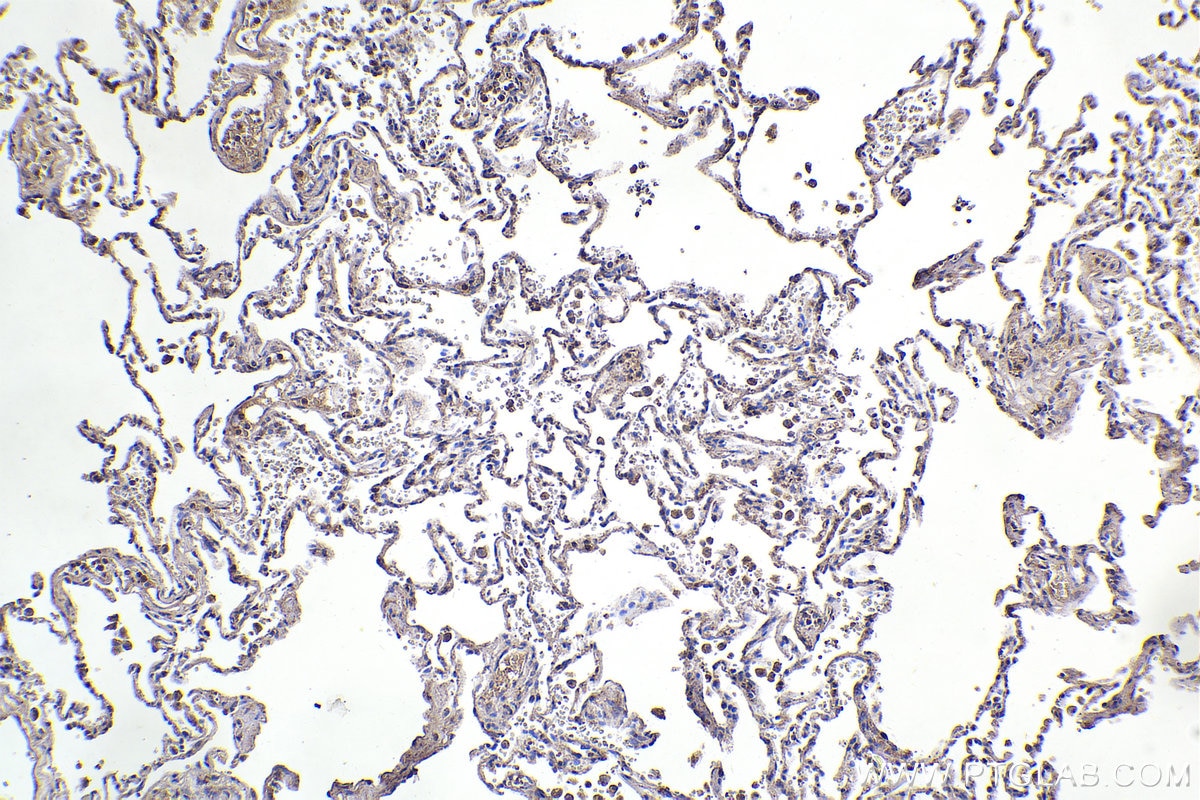 Immunohistochemistry (IHC) staining of human lung tissue using RPS9 Polyclonal antibody (18215-1-AP)