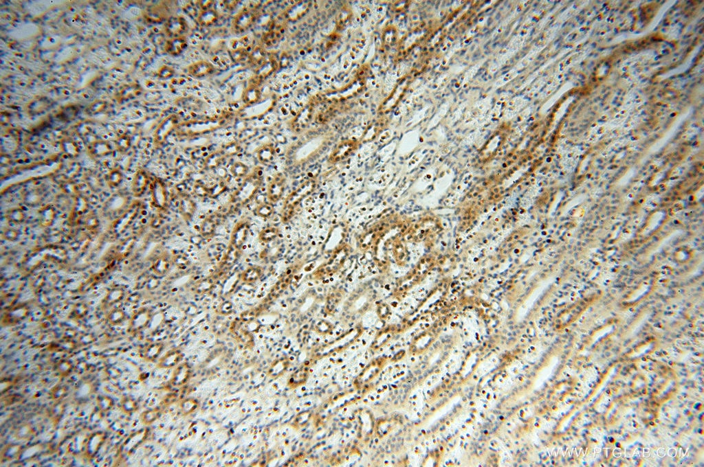 Immunohistochemistry (IHC) staining of human kidney tissue using RPS9 Polyclonal antibody (18215-1-AP)
