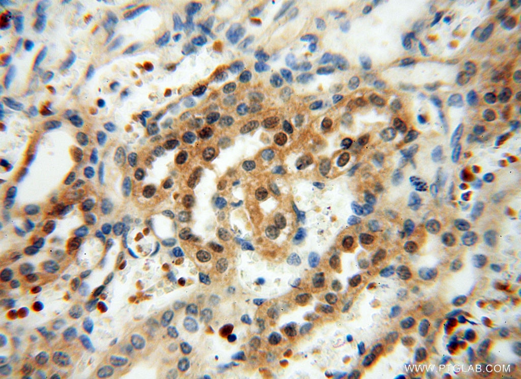 Immunohistochemistry (IHC) staining of human kidney tissue using RPS9 Polyclonal antibody (18215-1-AP)