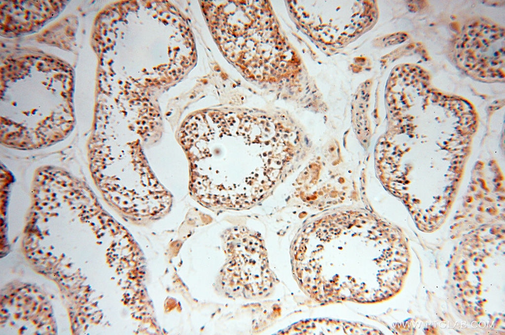 Immunohistochemistry (IHC) staining of human testis tissue using RPS9 Polyclonal antibody (18215-1-AP)