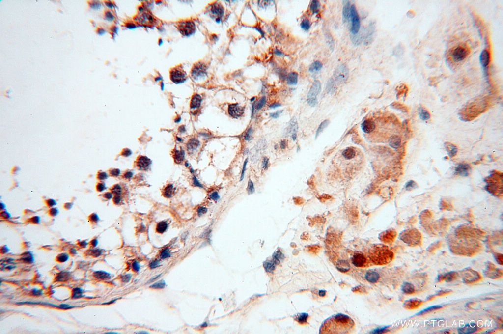 Immunohistochemistry (IHC) staining of human testis tissue using RPS9 Polyclonal antibody (18215-1-AP)