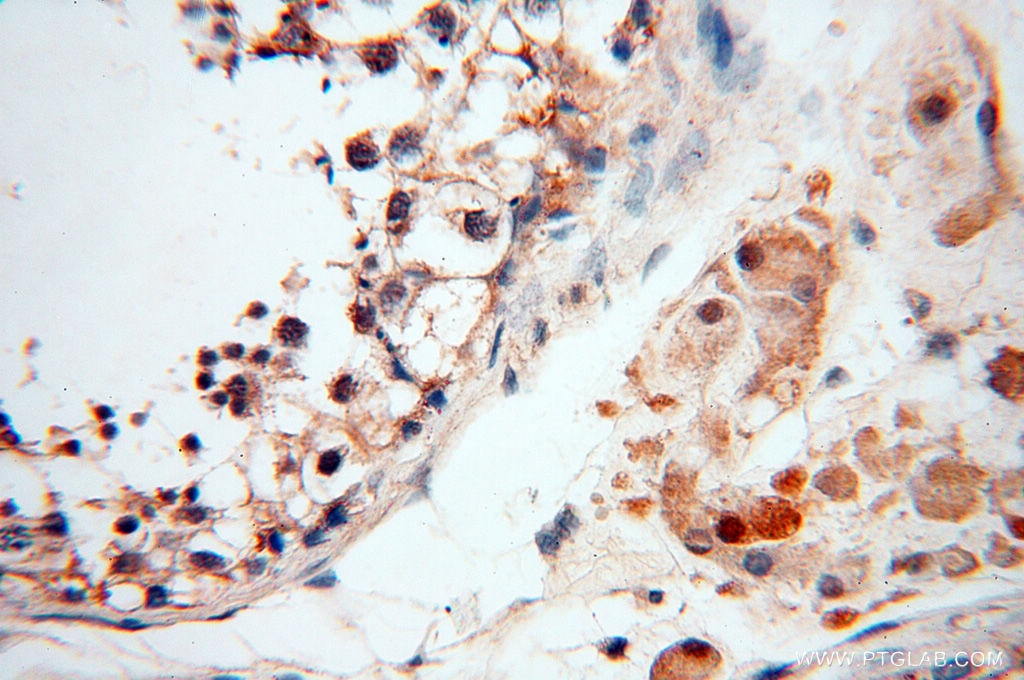 IHC staining of human testis using 18215-1-AP