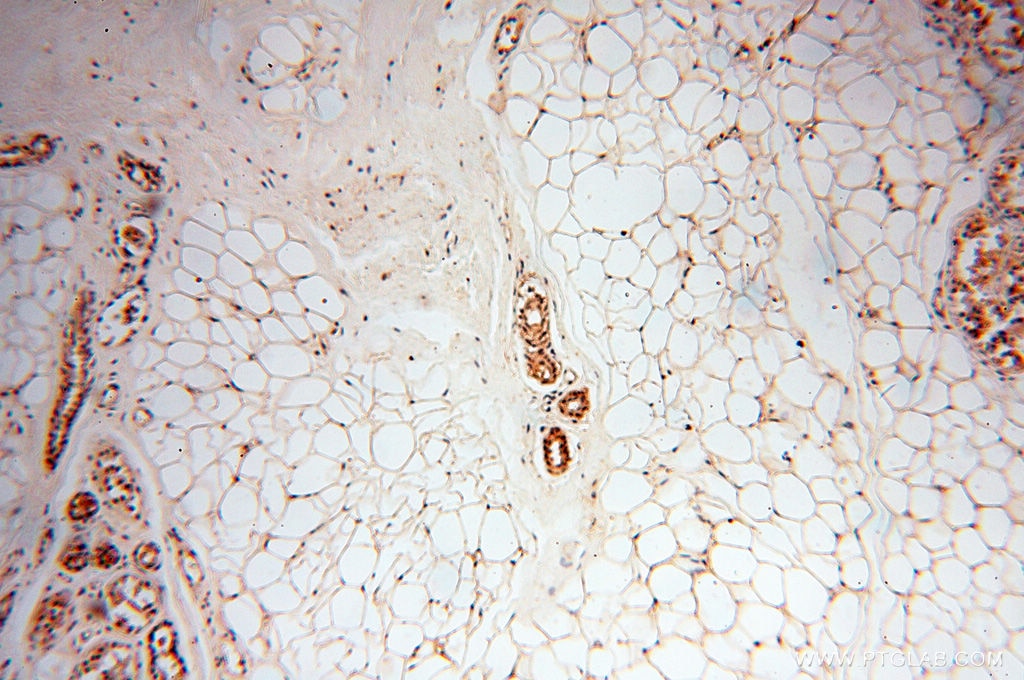 Immunohistochemistry (IHC) staining of human skin tissue using RPS9 Polyclonal antibody (18215-1-AP)