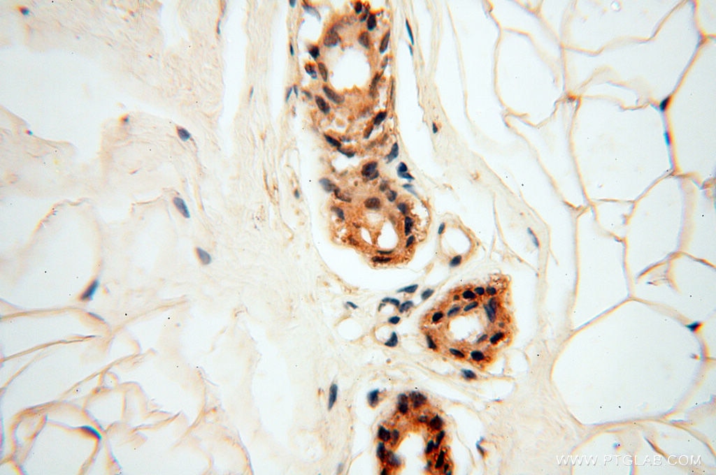 Immunohistochemistry (IHC) staining of human skin tissue using RPS9 Polyclonal antibody (18215-1-AP)