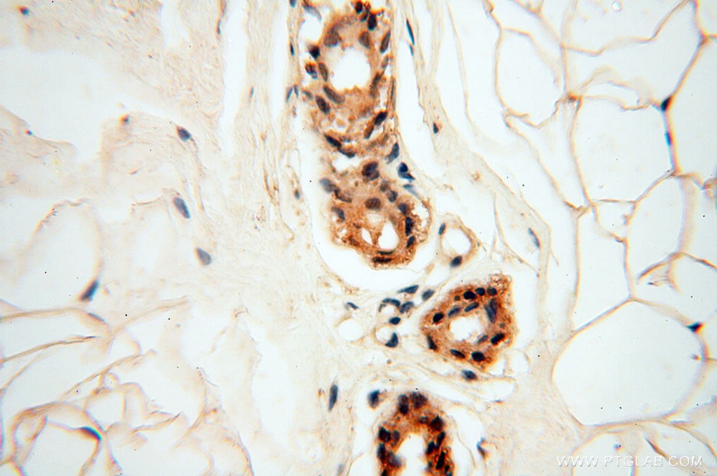 IHC staining of human skin using 18215-1-AP