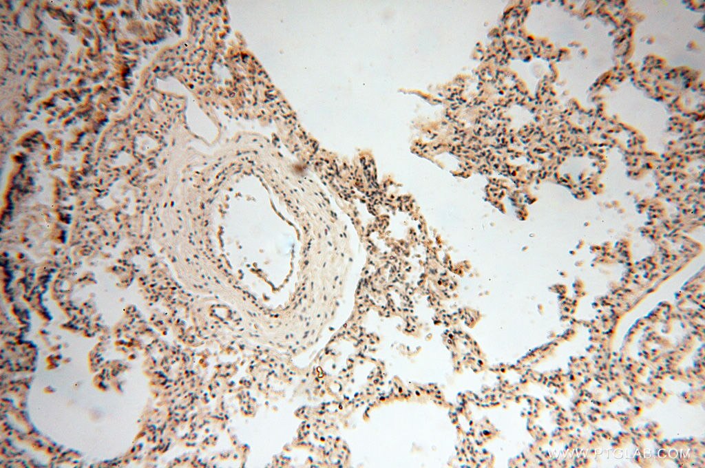 Immunohistochemistry (IHC) staining of human lung tissue using RPS9 Polyclonal antibody (18215-1-AP)