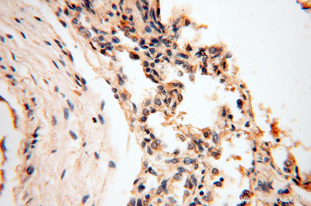 Immunohistochemistry (IHC) staining of human lung tissue using RPS9 Polyclonal antibody (18215-1-AP)