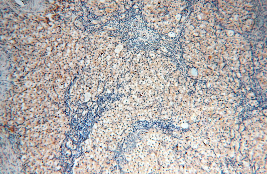 Immunohistochemistry (IHC) staining of human ovary tissue using RPS9 Polyclonal antibody (18215-1-AP)