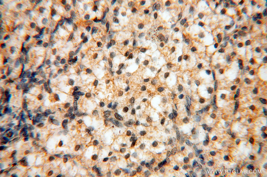 Immunohistochemistry (IHC) staining of human ovary tissue using RPS9 Polyclonal antibody (18215-1-AP)