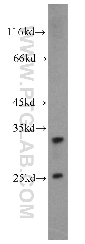 Western Blot (WB) analysis of mouse ovary tissue using RPS9 Polyclonal antibody (18215-1-AP)