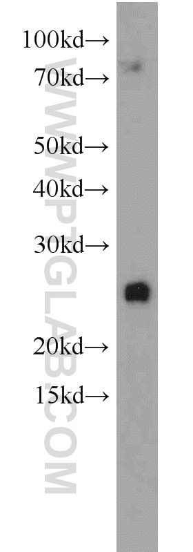 Western Blot (WB) analysis of HeLa cells using RPS9 Polyclonal antibody (18215-1-AP)