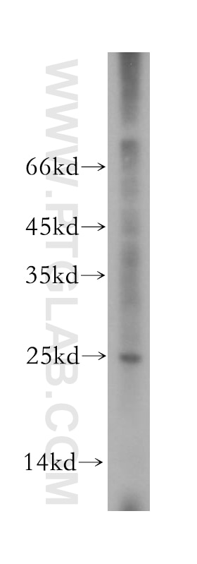 Western Blot (WB) analysis of mouse ovary tissue using RPS9 Polyclonal antibody (18215-1-AP)