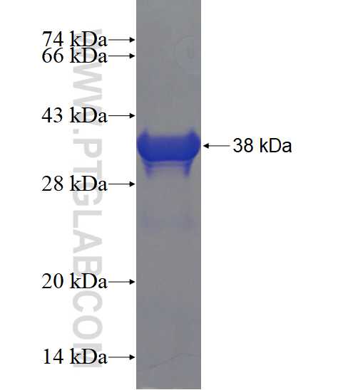 RPTN fusion protein Ag23257 SDS-PAGE