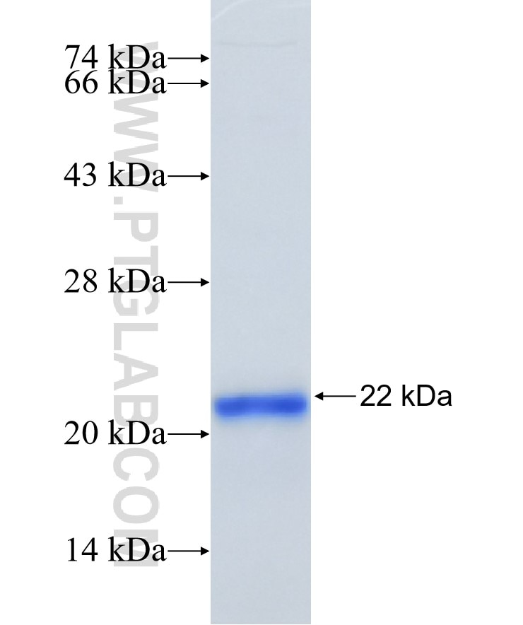 RPTN fusion protein Ag23299 SDS-PAGE
