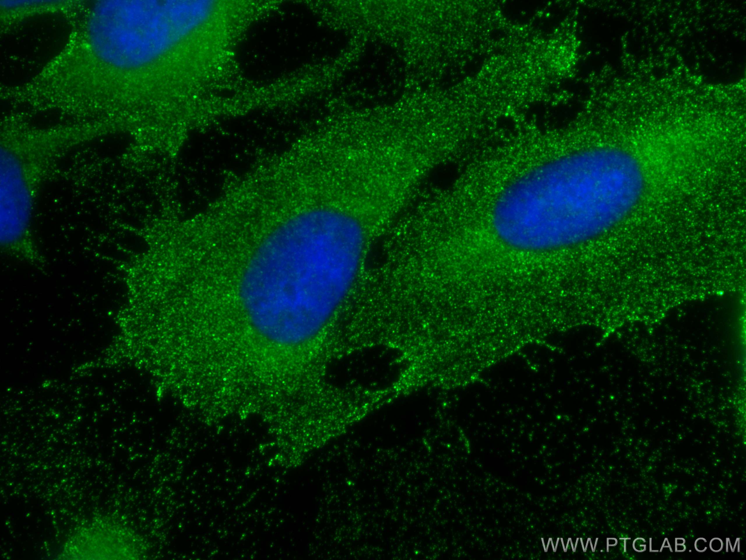 Immunofluorescence (IF) / fluorescent staining of U2OS cells using Raptor Polyclonal antibody (20984-1-AP)