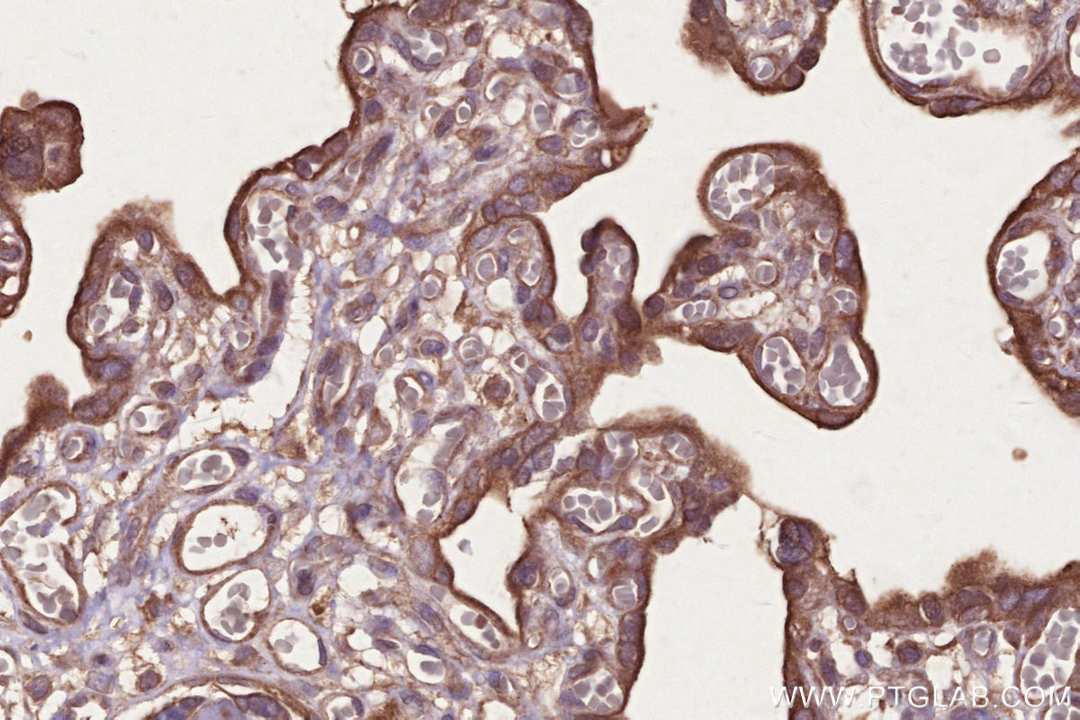 Immunohistochemistry (IHC) staining of human placenta tissue using Raptor Polyclonal antibody (20984-1-AP)