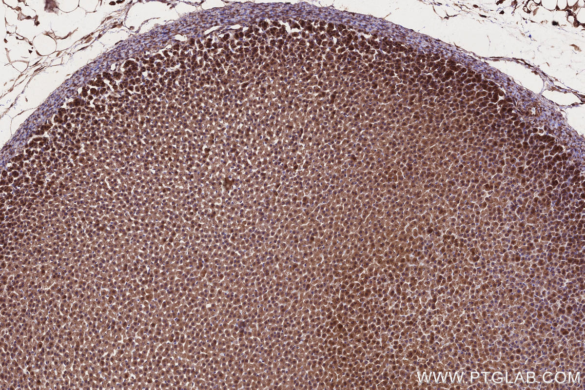Immunohistochemistry (IHC) staining of rat adrenal gland tissue using Raptor Polyclonal antibody (20984-1-AP)