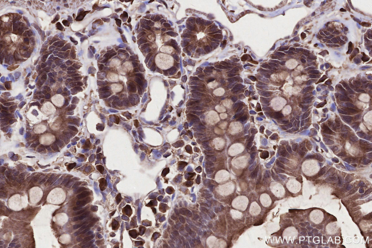 Immunohistochemistry (IHC) staining of rat small intestine tissue using Raptor Polyclonal antibody (20984-1-AP)