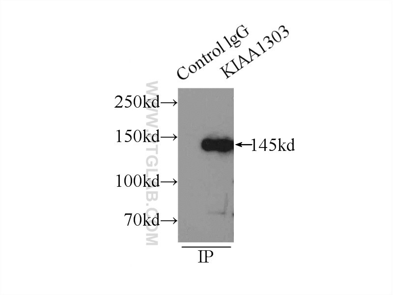Immunoprecipitation (IP) experiment of HeLa cells using Raptor Polyclonal antibody (20984-1-AP)
