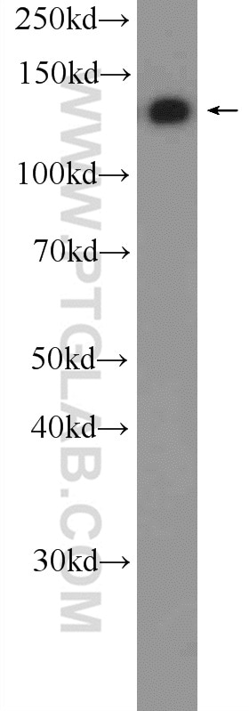 Raptor Polyclonal antibody