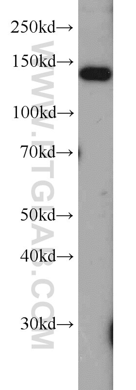 Raptor Polyclonal antibody