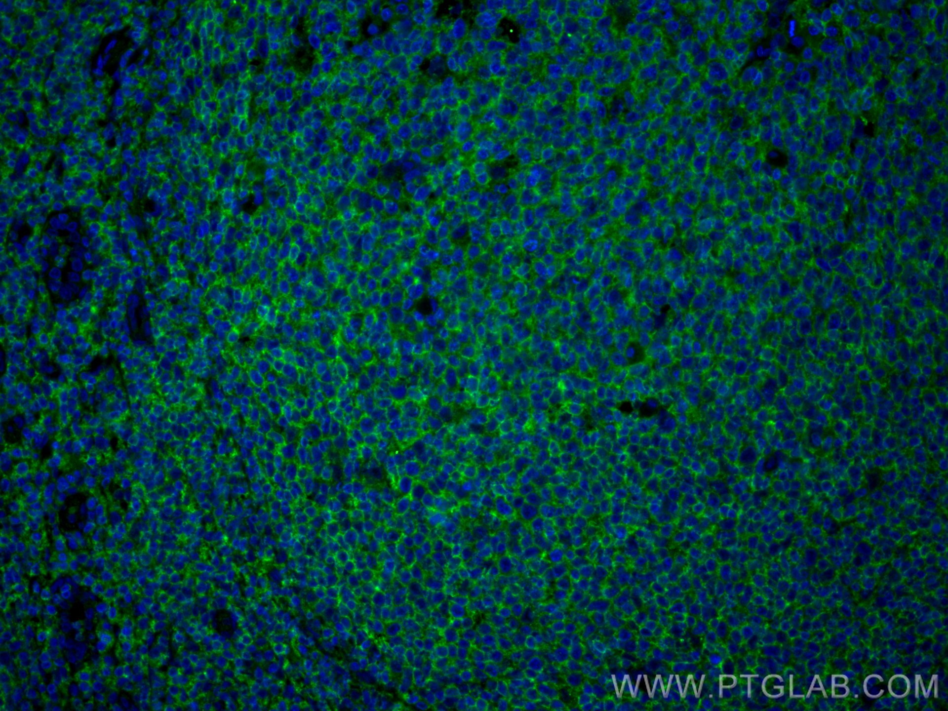 Immunofluorescence (IF) / fluorescent staining of human tonsillitis tissue using CD45 Polyclonal antibody (20103-1-AP)