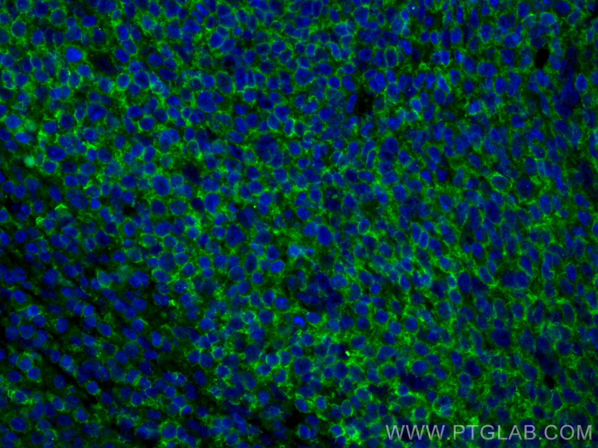 Immunofluorescence (IF) / fluorescent staining of human tonsillitis tissue using CD45 Polyclonal antibody (20103-1-AP)