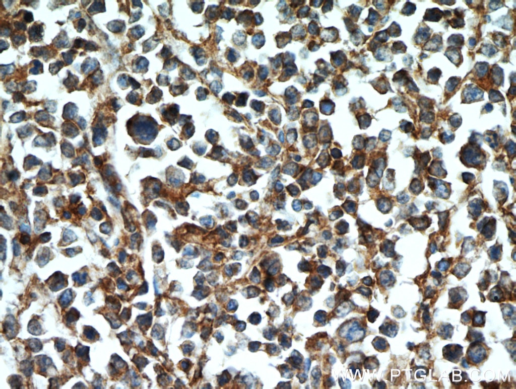 CD45 Polyclonal antibody