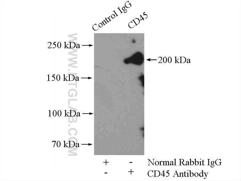 Immunoprecipitation (IP) experiment of mouse spleen tissue using CD45 Polyclonal antibody (20103-1-AP)