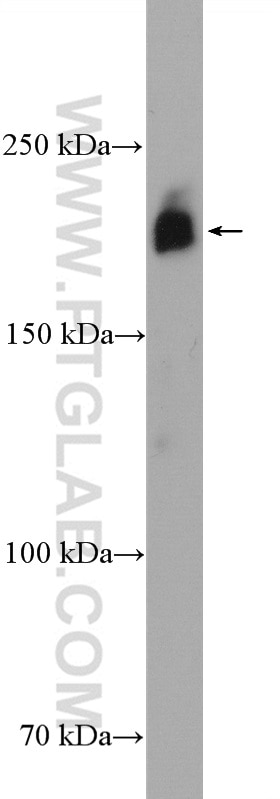 Western Blot (WB) analysis of mouse spleen tissue using CD45 Polyclonal antibody (20103-1-AP)