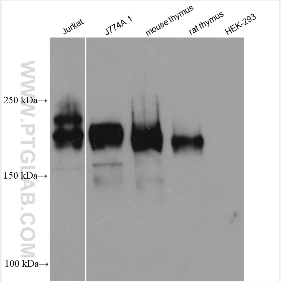 Western Blot (WB) analysis of various lysates using CD45 Polyclonal antibody (20103-1-AP)